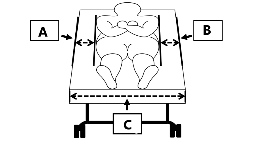 A patient lying supine on a bed, viewed from above. Measurement A runs from one mattress edge to the patient's widest part, B from the opposite mattress edge to the patient's other side, and C across the full width of the mattress.
